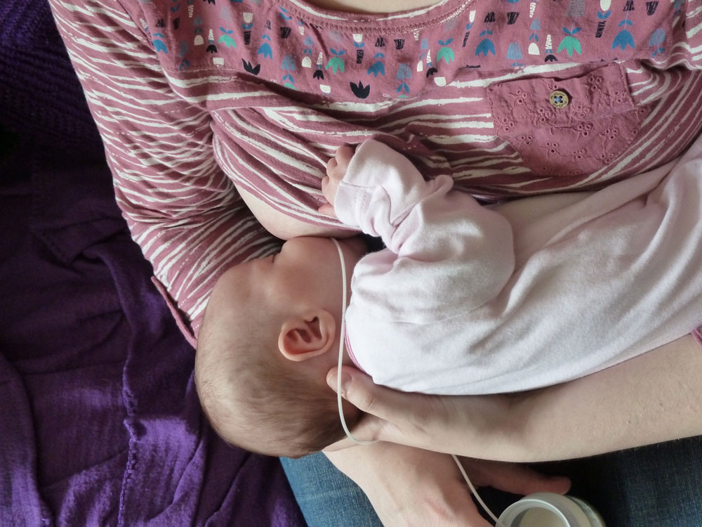 baby breastfeeding with home made supplemental nursing system