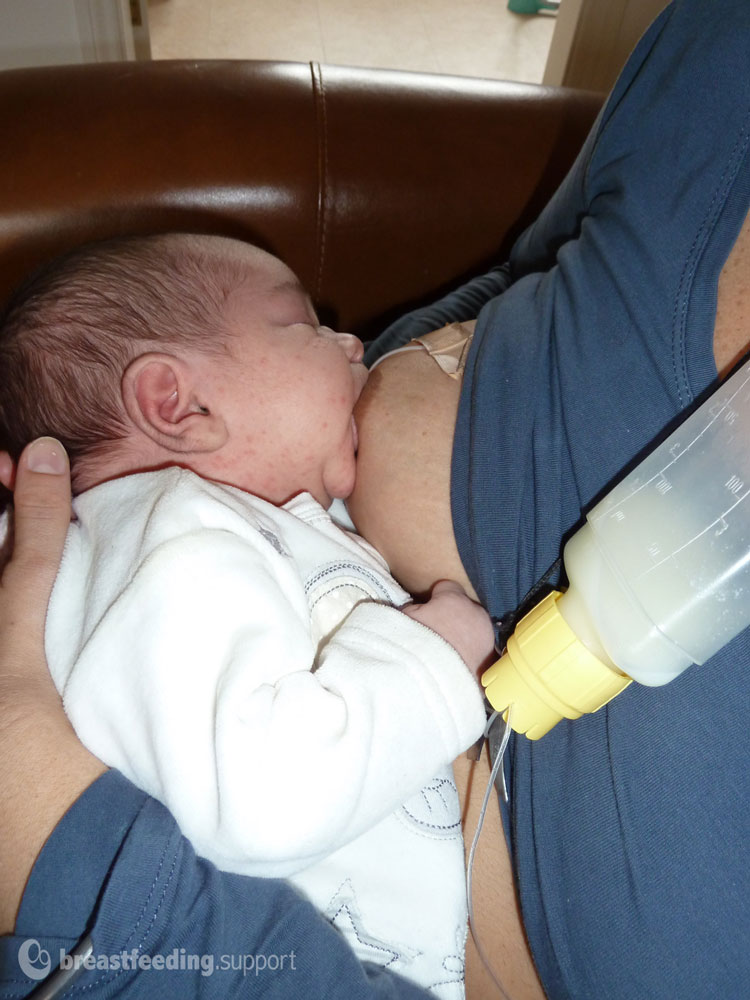Using a Medela Soft Feeder to avoid Nipple Confusion 