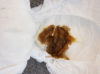 Image shows brown poop in a nappy