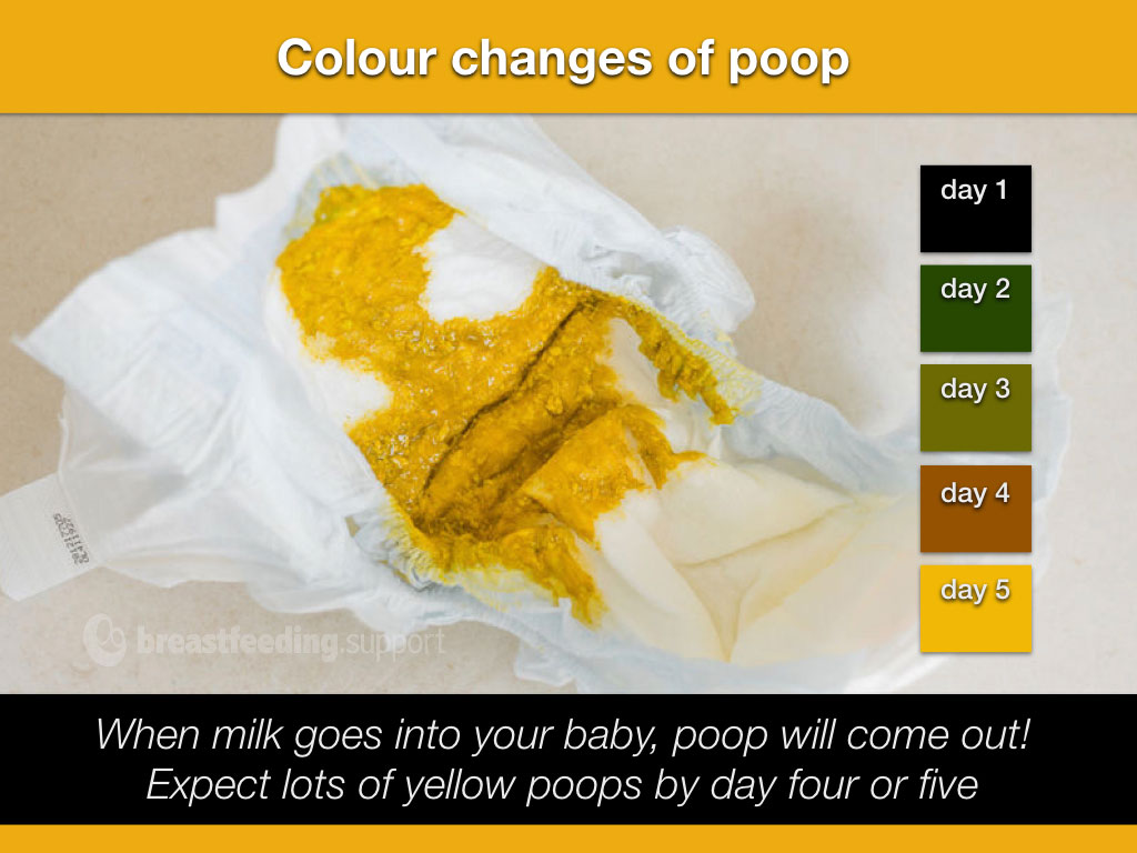 A nappy with mustard poop and colour blocks showing changing coloured poop