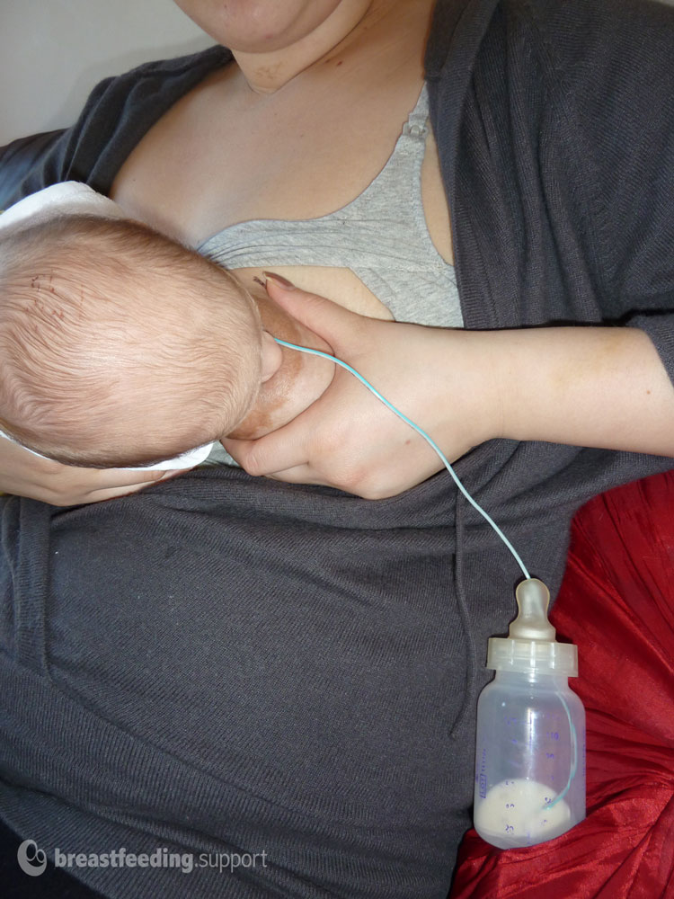 Homemade Supplemental Nursing System - Breastfeeding Support