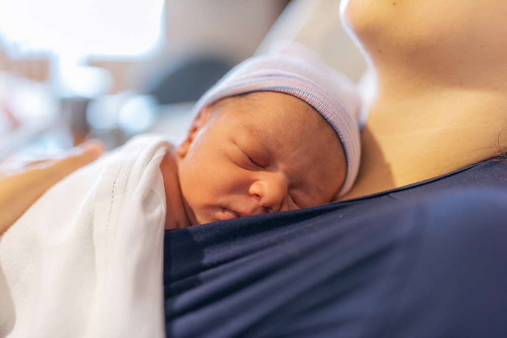 Using a nipple shield with a breastfed baby - ABM