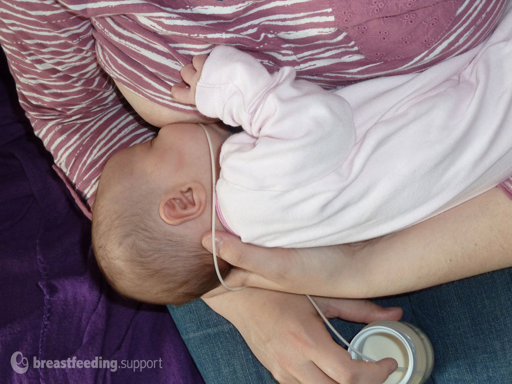 Baby breastfeeding with a home made supplemental nursing system