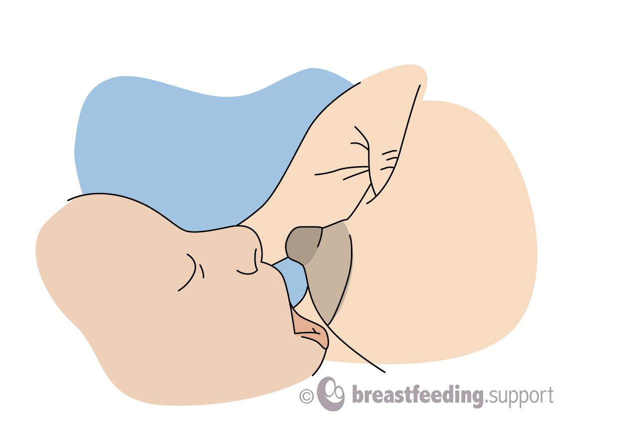 Incorrect posiion of the lips at the breast: narrow angle, shallow