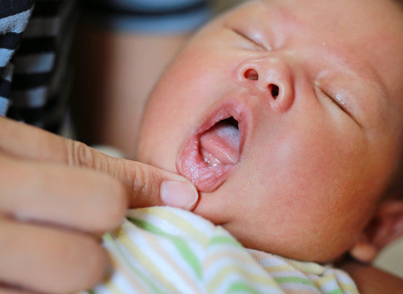 Thrush in nipples while hot sale breastfeeding