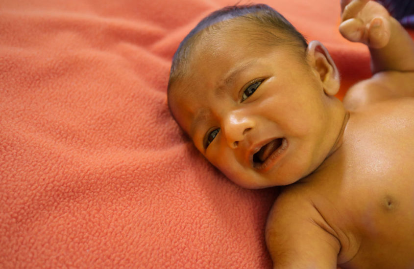 Breastfeeding.jaundice at Mauro Kennedy blog