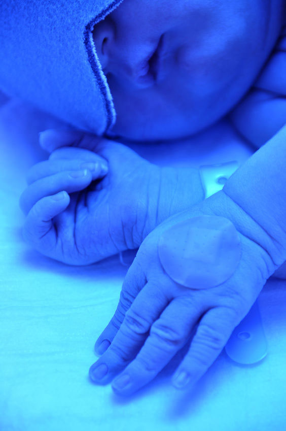 Baby in blue spectrum light with eye protection