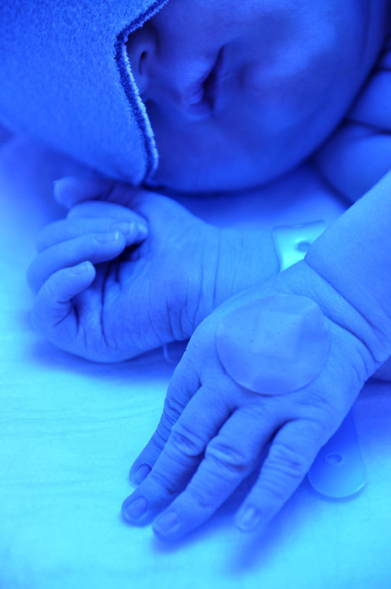 light for newborn jaundice