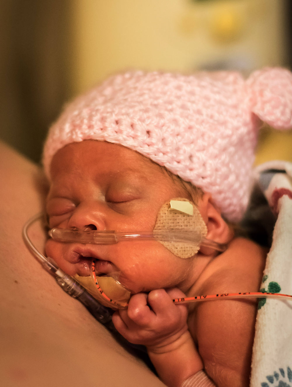 A mother's breast milk may help premature babies catch-up in growth