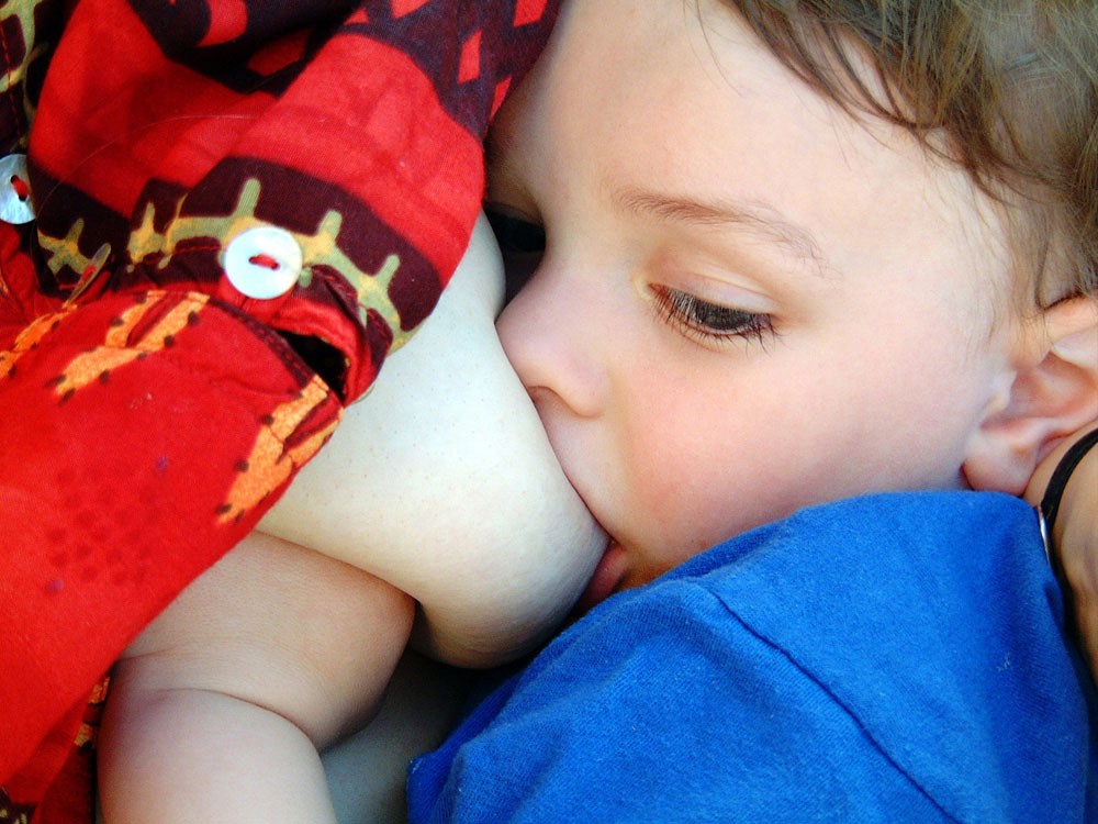 Lip Tie in Babies: Effects, Correction, Feeding Help